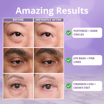 Instant Eye Tightener Easy-Wear Technology